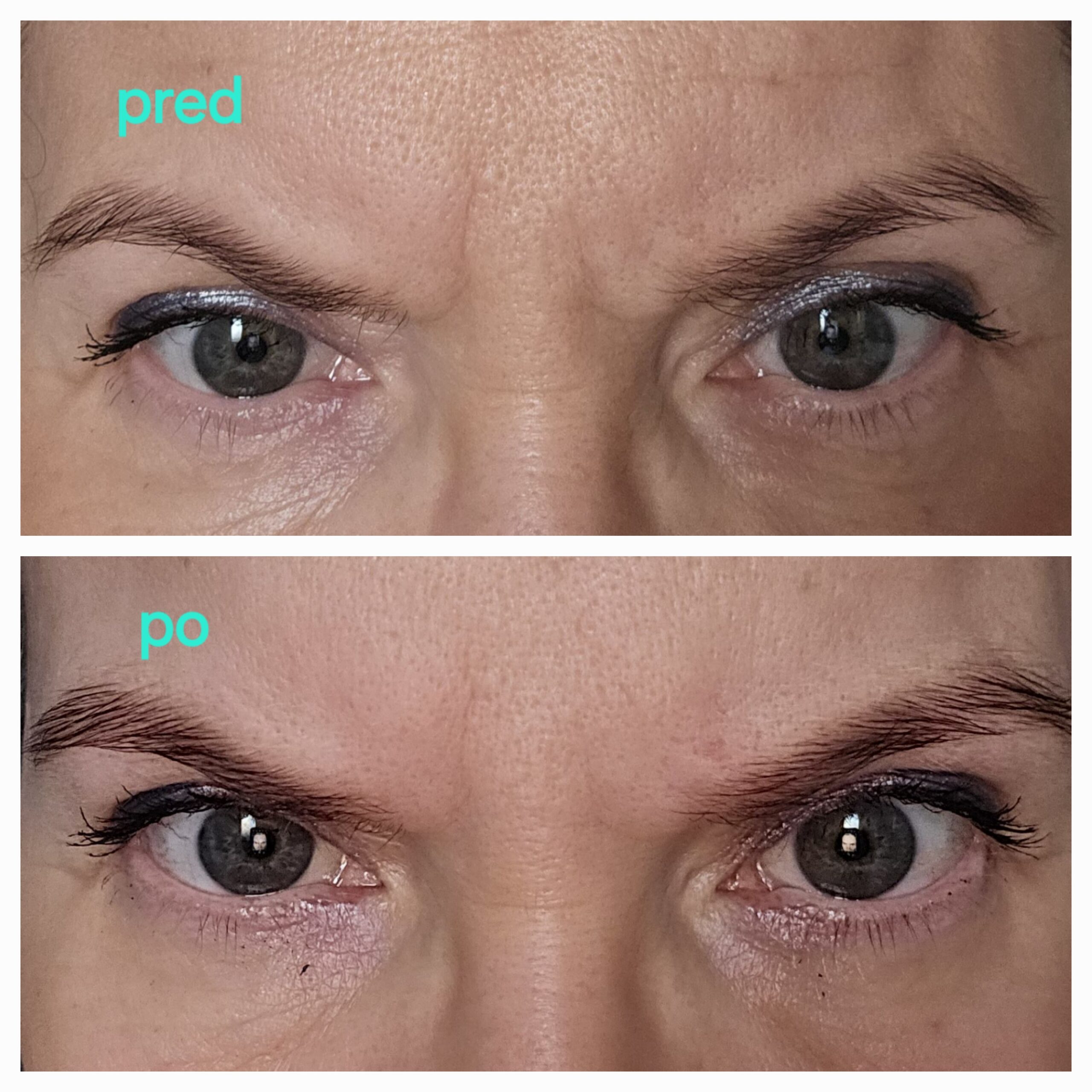 eyes